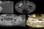 Planmeca CBCT Software Review: Romexis